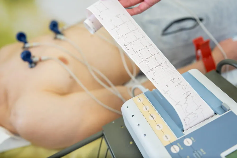 ECG Cardiac Evaluation