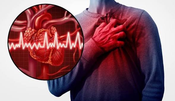 Heart Failure Management